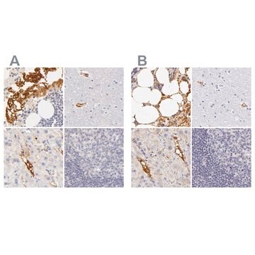 Anti-AHSG antibody produced in rabbit Prestige Antibodies&#174; Powered by Atlas Antibodies, affinity isolated antibody, buffered aqueous glycerol solution