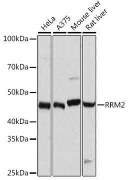 Anti-RRM2 Antibody, clone 10Y6E4, Rabbit Monoclonal