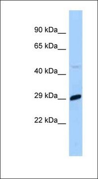 抗MXD1抗体 ウサギ宿主抗体 affinity isolated antibody