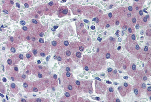 Anti-SLC27A2 antibody produced in rabbit affinity isolated antibody