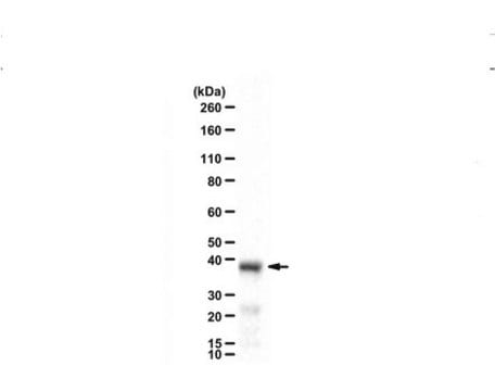 Anti-SET-beta Antibody serum, from rabbit