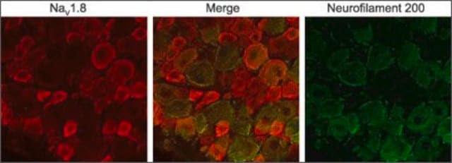 Anti-Sodium Channel NaV1.8 antibody produced in rabbit affinity isolated antibody, lyophilized powder