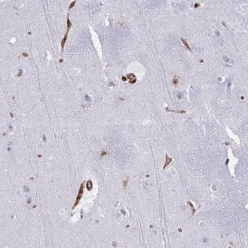 Anti-EML1 antibody produced in rabbit Prestige Antibodies&#174; Powered by Atlas Antibodies, affinity isolated antibody, buffered aqueous glycerol solution