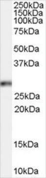 Anti-Homeobox B13 antibody produced in goat affinity isolated antibody, buffered aqueous solution