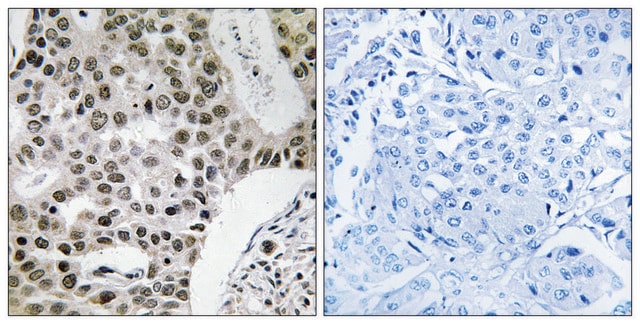 Anti-ZMYM4 antibody produced in rabbit affinity isolated antibody