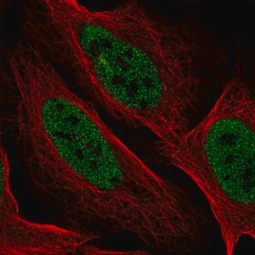 Anti-YDJC antibody produced in rabbit Prestige Antibodies&#174; Powered by Atlas Antibodies, affinity isolated antibody