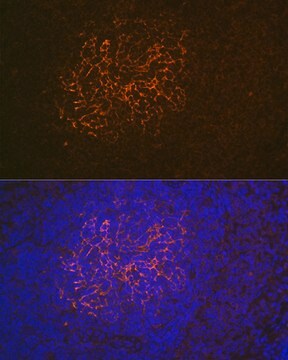 Anti-CR2/CD21 Antibody, clone 9F8A1, Rabbit Monoclonal