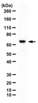 Anti-ITK/EMT/TSK Antibody from rabbit, purified by affinity chromatography