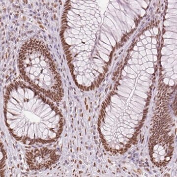 Anti-ZFR2 antibody produced in rabbit Prestige Antibodies&#174; Powered by Atlas Antibodies, affinity isolated antibody, buffered aqueous glycerol solution