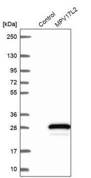 Anti-MPV17L2 antibody produced in rabbit Prestige Antibodies&#174; Powered by Atlas Antibodies, affinity isolated antibody, buffered aqueous glycerol solution