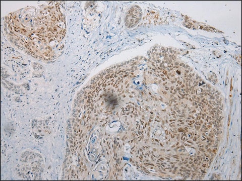 Anti-WDR45 affinity isolated antibody