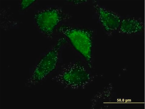 Anti-ACOX1 antibody produced in mouse purified immunoglobulin, buffered aqueous solution