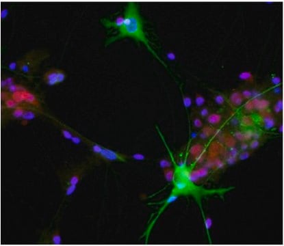 Anti-Aldolase C Antibody, C-Term, clone 1A1 clone 1A1, from mouse