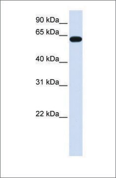 Anti-HS6ST3 antibody produced in rabbit affinity isolated antibody