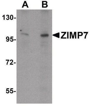 Anti-ZIMP7 antibody produced in rabbit affinity isolated antibody