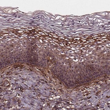 Anti-AEBP1 antibody produced in rabbit Prestige Antibodies&#174; Powered by Atlas Antibodies, affinity isolated antibody, buffered aqueous glycerol solution