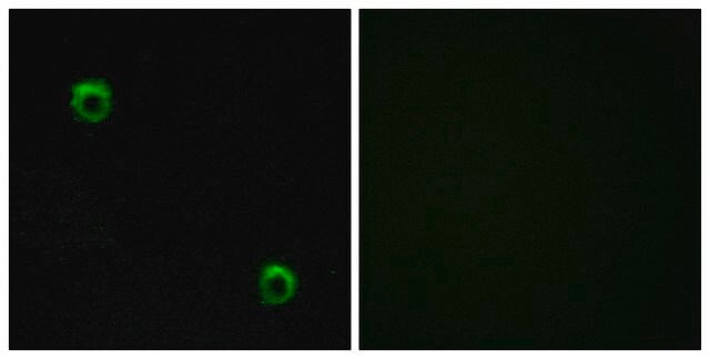 Anti-FZD2 antibody produced in rabbit affinity isolated antibody