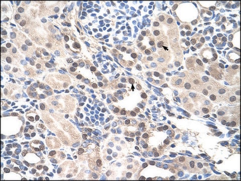 Anti-RORA (AB3) antibody produced in rabbit IgG fraction of antiserum