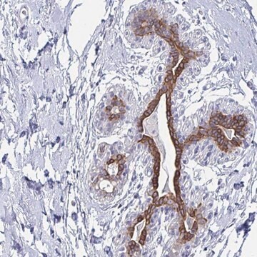 Anti-FAM46D antibody produced in rabbit Prestige Antibodies&#174; Powered by Atlas Antibodies, affinity isolated antibody, buffered aqueous glycerol solution