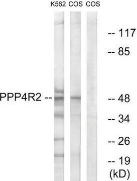 Anti-PPP4R2 antibody produced in rabbit affinity isolated antibody