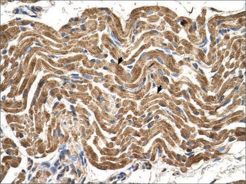 Anti-ATP5B (AB2) antibody produced in rabbit IgG fraction of antiserum