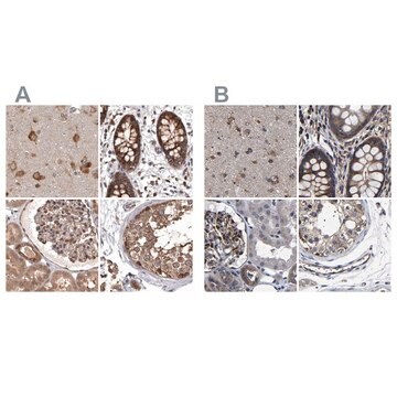 Anti-DARS antibody produced in rabbit Prestige Antibodies&#174; Powered by Atlas Antibodies, affinity isolated antibody, buffered aqueous glycerol solution, ab2