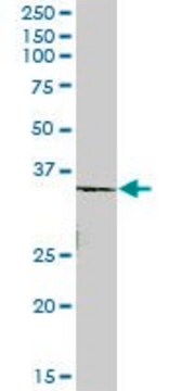 Anti-ROM1 antibody produced in mouse purified immunoglobulin, buffered aqueous solution