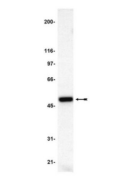 Anticuerpo anti-p47-fox serum, Upstate&#174;