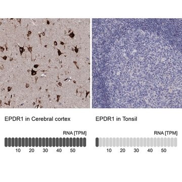 Anti-EPDR1 antibody produced in rabbit Prestige Antibodies&#174; Powered by Atlas Antibodies, affinity isolated antibody, buffered aqueous glycerol solution