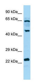 Anti-DUSP14 (C-terminal) antibody produced in rabbit affinity isolated antibody