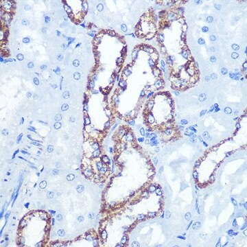 Anti- HK1 antibody produced in rabbit