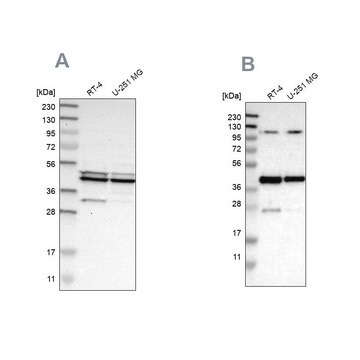 Anti-CFAP36 antibody produced in rabbit Prestige Antibodies&#174; Powered by Atlas Antibodies, affinity isolated antibody, buffered aqueous glycerol solution