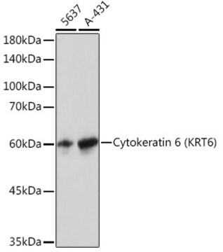 Anti-Cytokeratin 6 (KRT6) Antibody, clone 1T4Z8, Rabbit Monoclonal