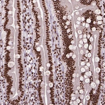 Anti-NSMCE2 antibody produced in rabbit Prestige Antibodies&#174; Powered by Atlas Antibodies, affinity isolated antibody, buffered aqueous glycerol solution