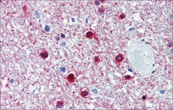 Anti-ONECUT1 (ab2) antibody produced in rabbit affinity isolated antibody