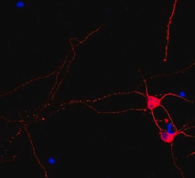 Anticuerpo anti-beta III tubulina, conjugado con Cy3 from rabbit, CY3 conjugate