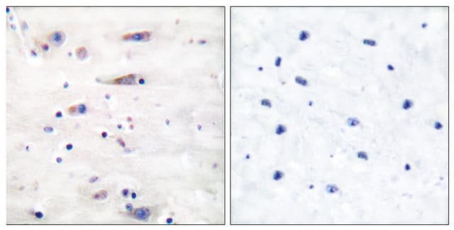 Anti-NMDAR1 antibody produced in rabbit affinity isolated antibody