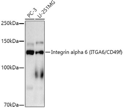 Anti-Integrin alpha 6 (ITGA6/CD49f) Antibody, clone 7U5Z0, Rabbit Monoclonal