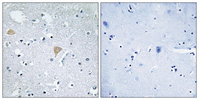 Anti-CTRO antibody produced in rabbit affinity isolated antibody