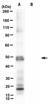 Anti-Nebulin exon 143 Antibody, clone NEB-3F4