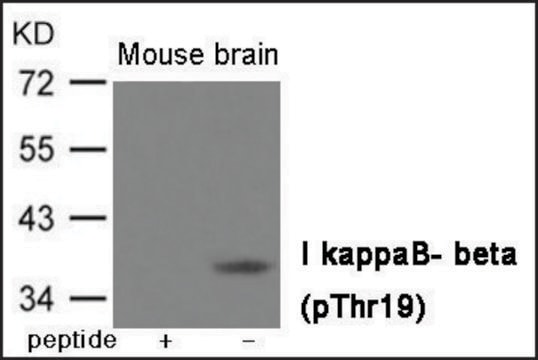 Anti-phospho-I&#954;B-&#946; (pThr19) antibody produced in rabbit affinity isolated antibody