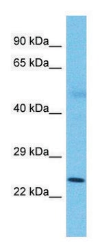 Anti-SLC25A26 (N-terminal) antibody produced in rabbit affinity isolated antibody