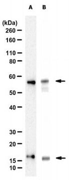 Anti-Desmin Antibody, clone DE-U-10