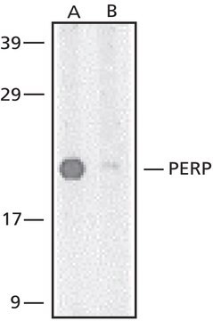 Anti-PERP antibody produced in rabbit ~0.5&#160;mg/mL, affinity isolated antibody, buffered aqueous solution