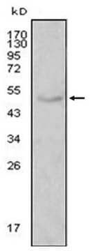 Anti-LPL Antibody, clone 2C5 ascites fluid, clone 2C5, from mouse