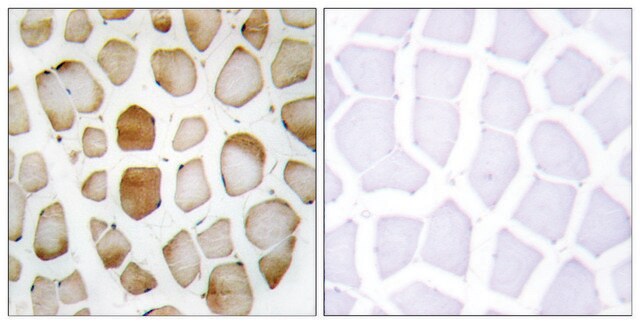 Anti-ATG4B antibody produced in rabbit affinity isolated antibody