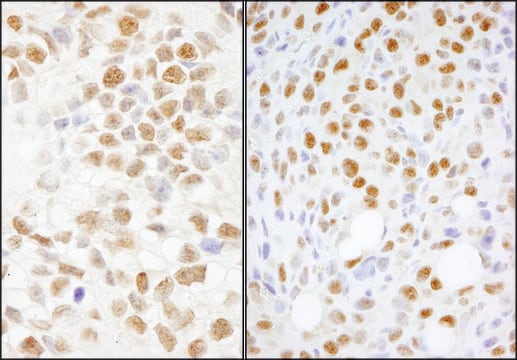 Rabbit anti-NONO Antibody, Affinity Purified Powered by Bethyl Laboratories, Inc.