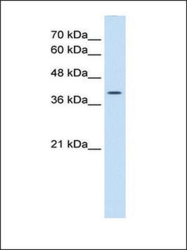 Anti-WNT2B antibody produced in rabbit affinity isolated antibody