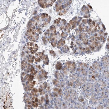 Anti-SLC25A29 antibody produced in rabbit Prestige Antibodies&#174; Powered by Atlas Antibodies, affinity isolated antibody, buffered aqueous glycerol solution