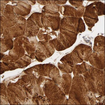 Anti-CACNA1G antibody produced in rabbit Prestige Antibodies&#174; Powered by Atlas Antibodies, affinity isolated antibody, buffered aqueous glycerol solution